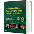  Computed Body Tomography with MRI Correlation